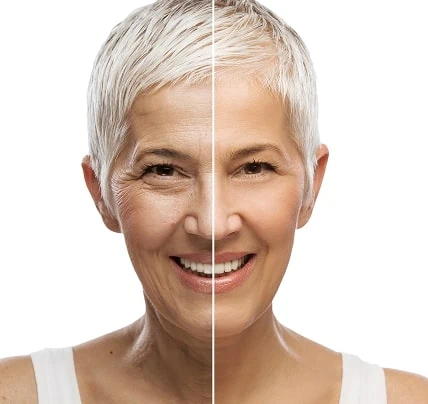 Before and After